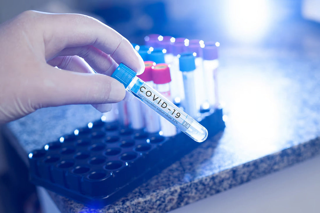 Covid Cases in Bangalore